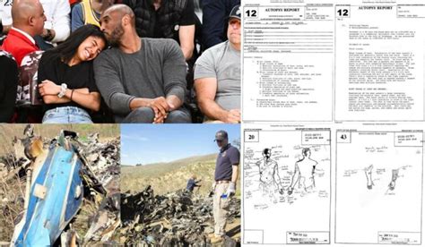 kobes autopsy|Kobe Bryant Autopsy Report: His Cause of Death。